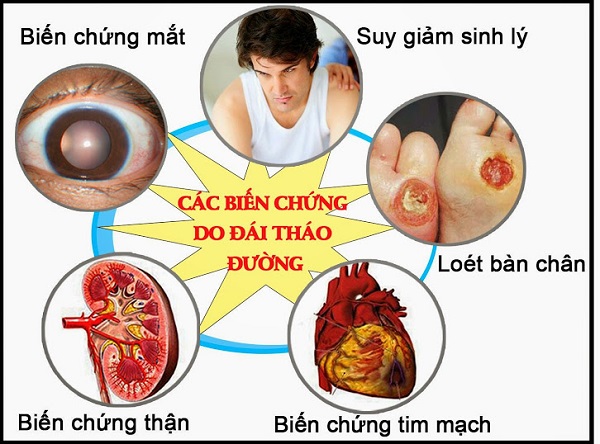 Biến chứng của bệnh đái tháo đường: các biện pháp phòng ngừa